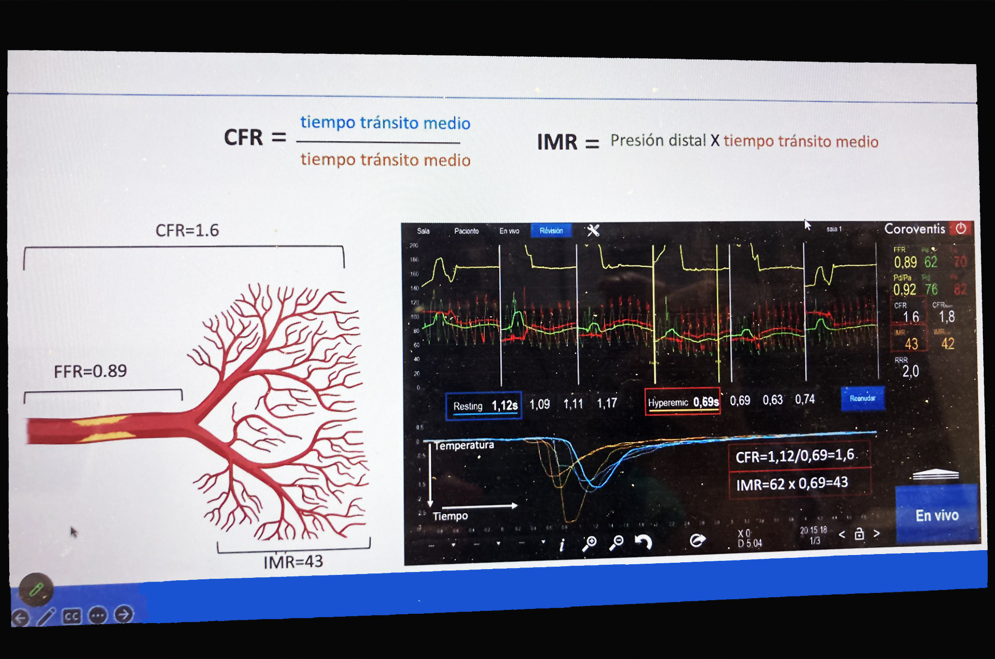 Ponencia 'Evaluación y manejo del paciente con disfunción microvascular coronaria'